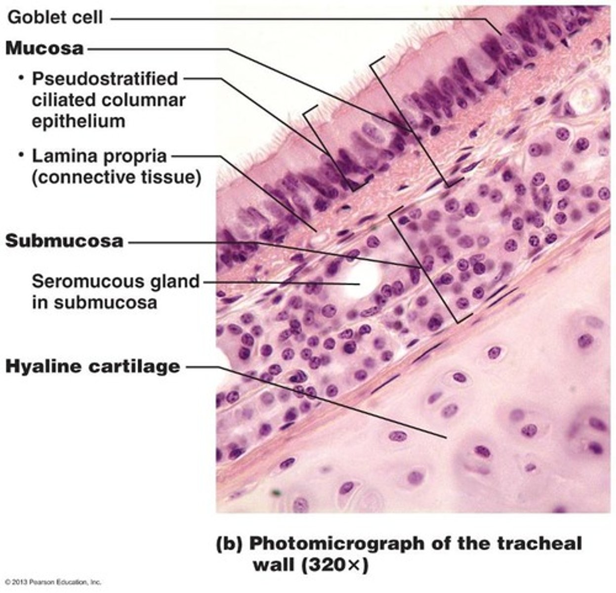 <p>layers- mucosa- ciliated pseudostratified columnar epithelium with goblet cells (mucus producing cells); mucus sticks to dirt/dust particles and is swept out of respiratory tract by cilia</p><p>submucosa</p><p>cartilage- hyaline cartilage</p><p>adventitia- external layer</p>