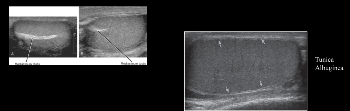 <p>What fibrous capsule surrounds the testicles?</p>