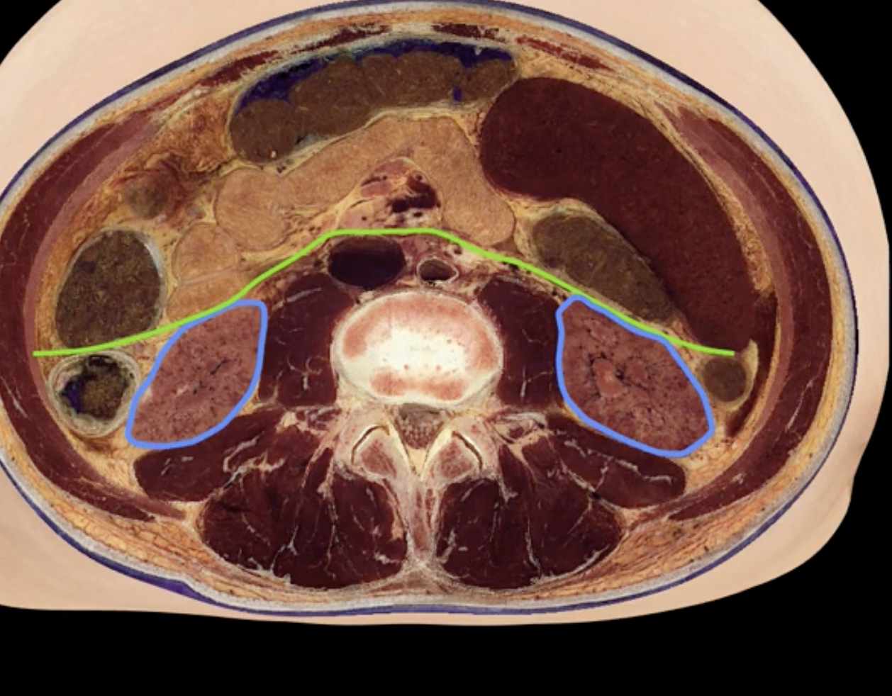 <p>green and blue are showing that the kidneys are retroperitoneal</p>