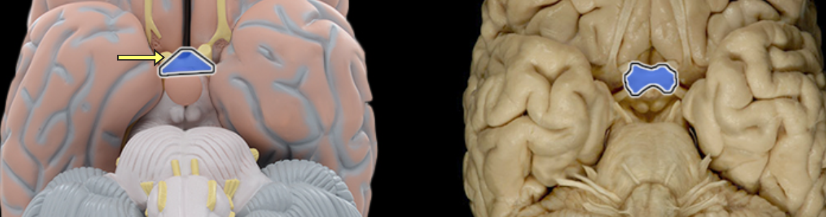 <p>Location:</p><ul><li><p>Ventral aspect of diencephalon</p></li><li><p>Between optic nerves and optic tracts</p></li></ul><p>Description:</p><ul><li><p>White matter tract composed of axons of retinal ganglion cells from both eyes traveling to thalamus and other brainstem nuclei</p></li><li><p>Some axons from each retina decussate (cross) in chiasm to enter opposite optic tract</p></li></ul><p>Comment:</p><ul><li><p>Retinal ganglion cell axon pathway: optic nerve > optic chiasm > optic tract > brainstem nuclei (including lateral geniculate nucleus of thalamus)</p></li></ul><p></p>