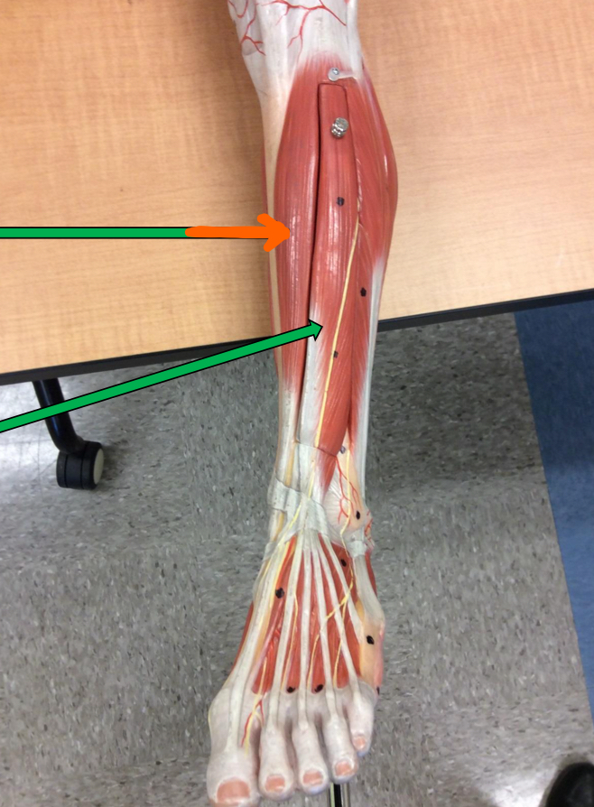 <p>Identify this muscle?</p>