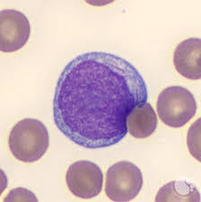 <p>What distinguishes a Myeloblast from a Lymphocyte? This image is of a myeloblast.</p>