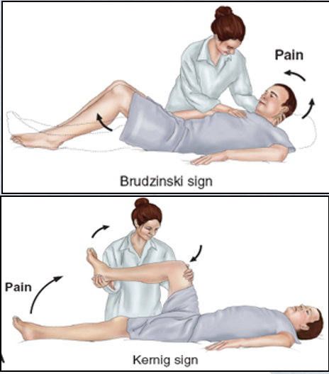 <ul><li><p>Fever &amp; chills</p></li><li><p>Steady, throbbing headache</p></li><li><p><span style="color: yellow"><strong>Nuchal rigidity</strong></span>:</p><ul><li><p>Neck immobility—an early sign!</p></li><li><p>Trying to flex the neck causes spasms…</p></li></ul></li><li><p><span style="color: yellow"><strong>Positive Kernig sign</strong></span>:</p><ul><li><p>Patient lying down with thigh flexed on abdomen, leg cannot be extended</p><ul><li><p><strong>If bilateral</strong>: meningeal irritation</p></li></ul></li></ul></li><li><p><span style="color: yellow"><strong>Positive Brudzinski sign</strong></span>:</p><ul><li><p>Patient's neck flexed → knees &amp; hips flexed too</p><ul><li><p>Lower extremity of one side is passively flexed, the same thing happens on the opposite extremity</p></li><li><p><strong><u>Brudzinski &gt; Kernig when indicating meningitis</u></strong></p></li></ul></li></ul></li><li><p>Photophobia</p></li><li><p><span style="color: yellow"><strong>Rash</strong></span>:</p><ul><li><p>Common feature with meningococcal meningitidis (half of patients present with rash)</p></li><li><p>Skin lesions that have develop into varying degrees of petechiae, lesions and bruising</p></li></ul></li><li><p>Disorientation &amp; memory impairment</p></li><li><p>Seizures</p></li><li><p>Mental status changes</p></li><li><p>Irritability</p></li><li><p>Hyperactive DTRs</p></li></ul><p><strong><em>**Older adults - have more behavior changes &amp; focal neurologic deficits</em></strong></p>