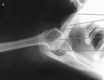 <p>What type of projection, position and anatomy is this?</p>