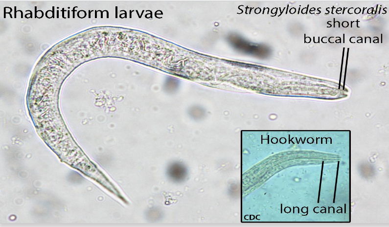 <p>strongyloides stercoralis rhabditiform larvae</p>