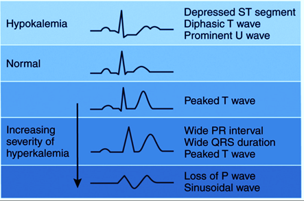 <p>Heart and skeletal muscles. </p><p>EKG changes:</p><p>Arrhythmias (irregular heart rhythm)</p><p>weakness</p>