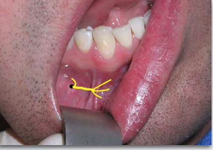 <p>what nerve is indicated here?</p>