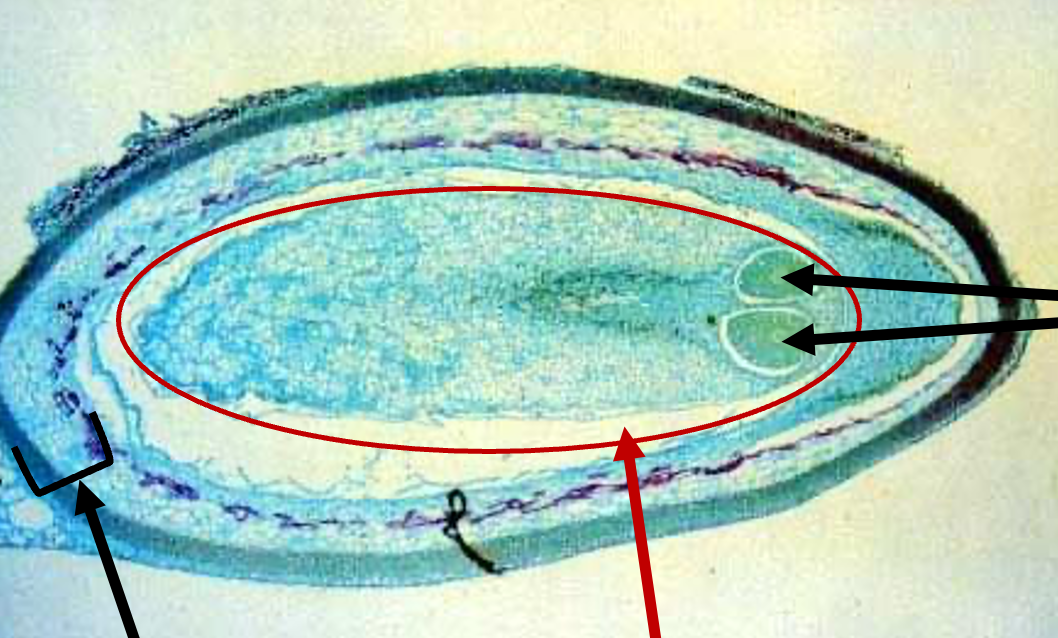 <p>Megagametophyte</p>