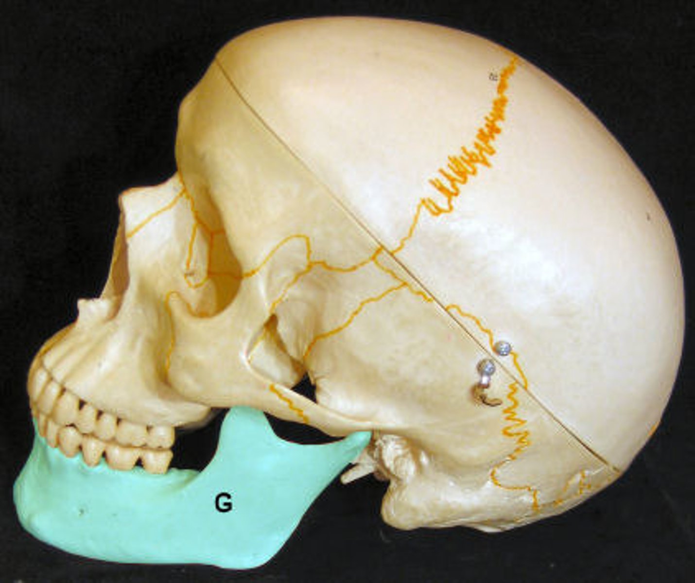 <p>Facial bone (1). Lower jaw.</p>