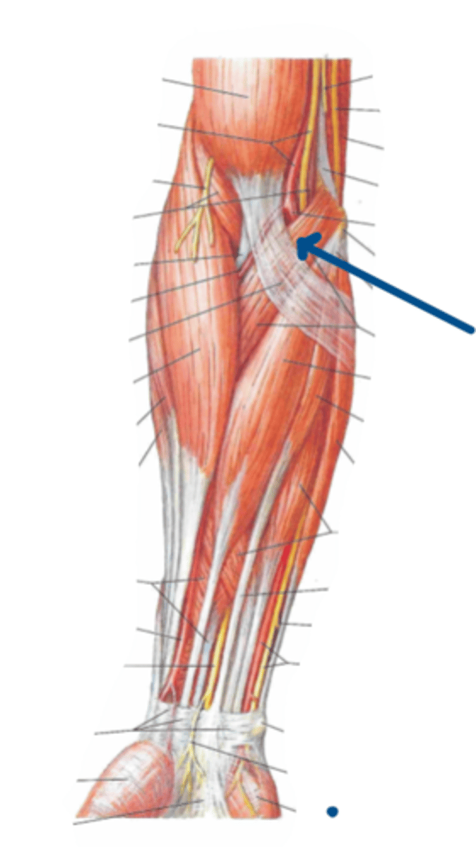 <p>Identify the innervation of the structure indicated by the arrow</p>