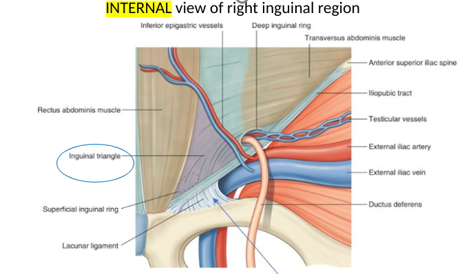 <p>where direct inguinal hernia protrudes thru</p><p></p><p>lateral border: inferior epigastric vessels</p><p>medial border: rectus abdominis (lateral side)</p><p>inferior border: inguinal ligament</p>