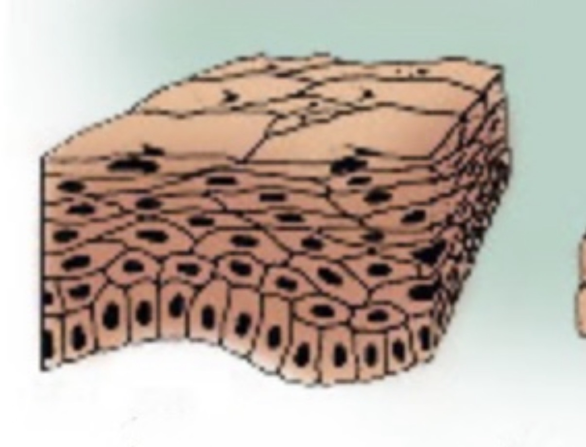 <p>What type of Epithelium is this?</p>