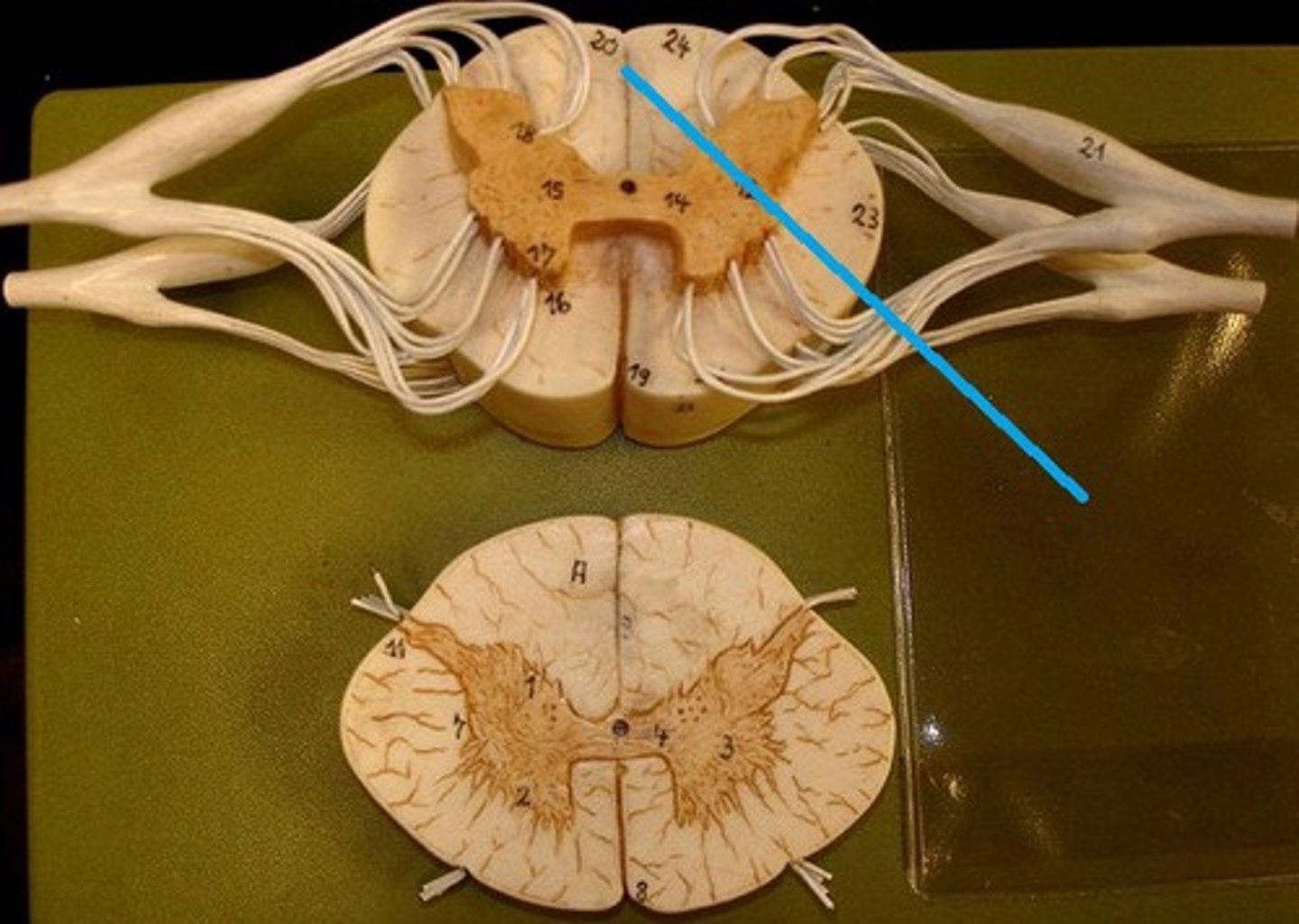 <p>a shallow vertical groove dividing the spinal cord throughout its whole length in the midline posteriorly.</p>