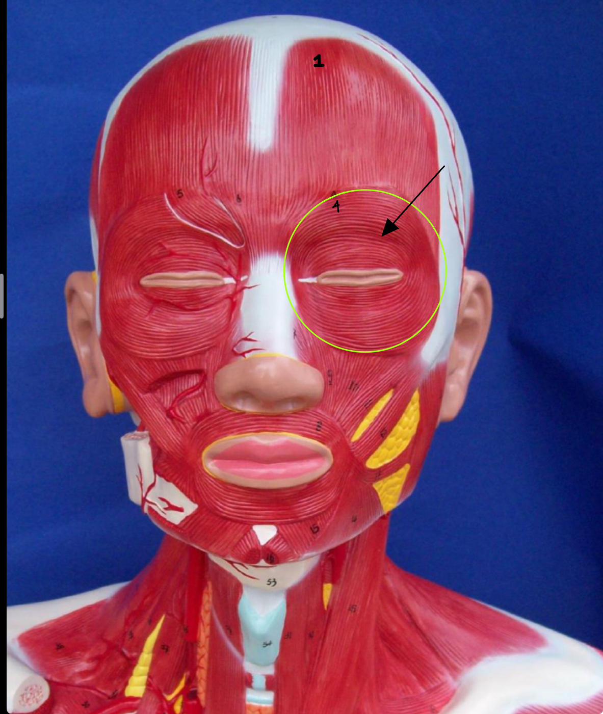 <p>what type of muscle is this ( altay model)</p>