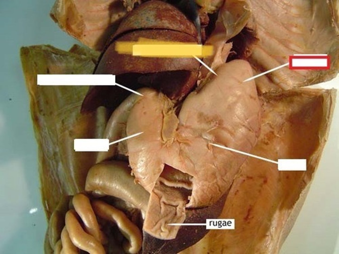 <p>name this organ</p>
