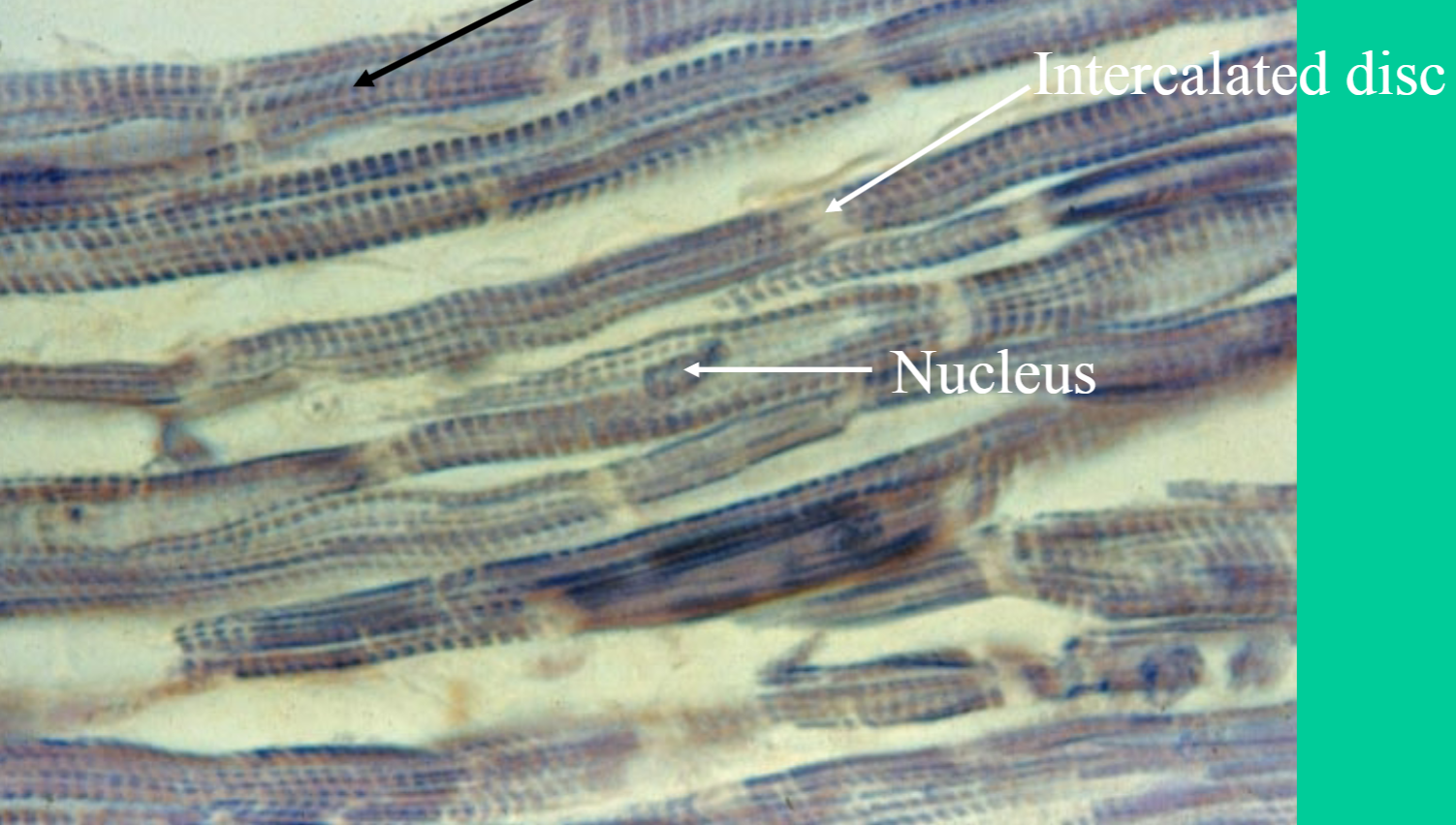 <p>Where is the cardiac muscular tissue found?</p>