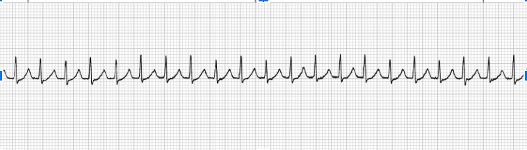 <p>what rhythm is this</p>