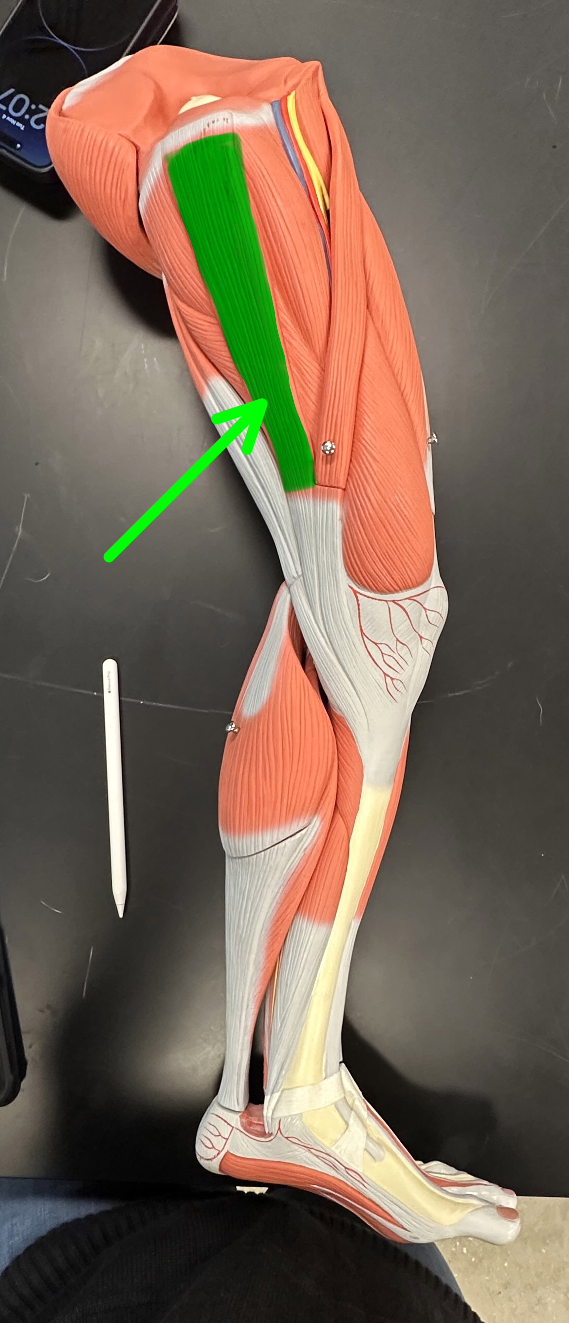 <p>What is the highlighted structure</p>