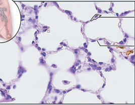 <p>Simple Squamous Epithelium</p>