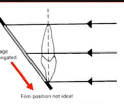 <p>film position not ideal </p>