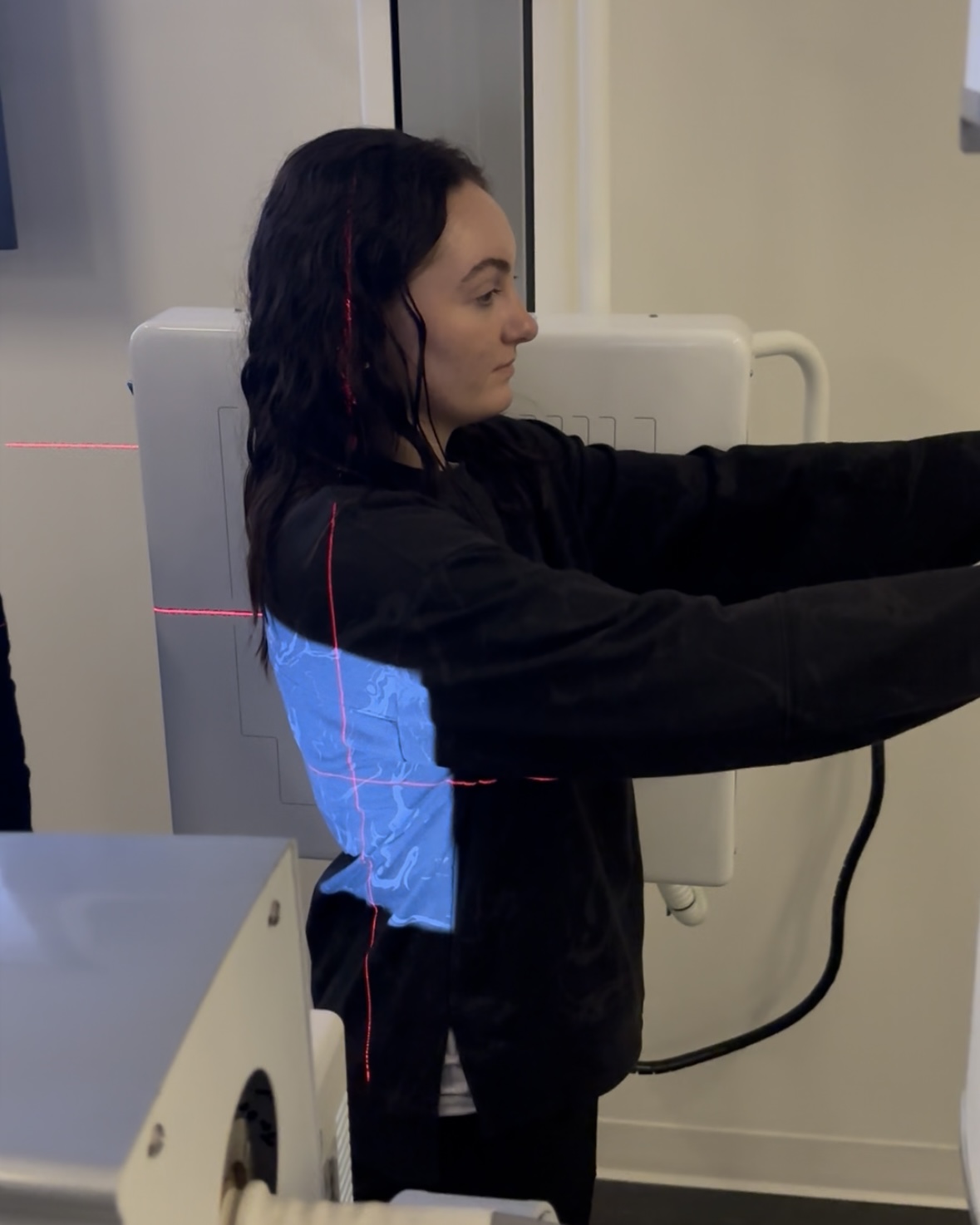 <p>Scoliosis- Lateral</p>