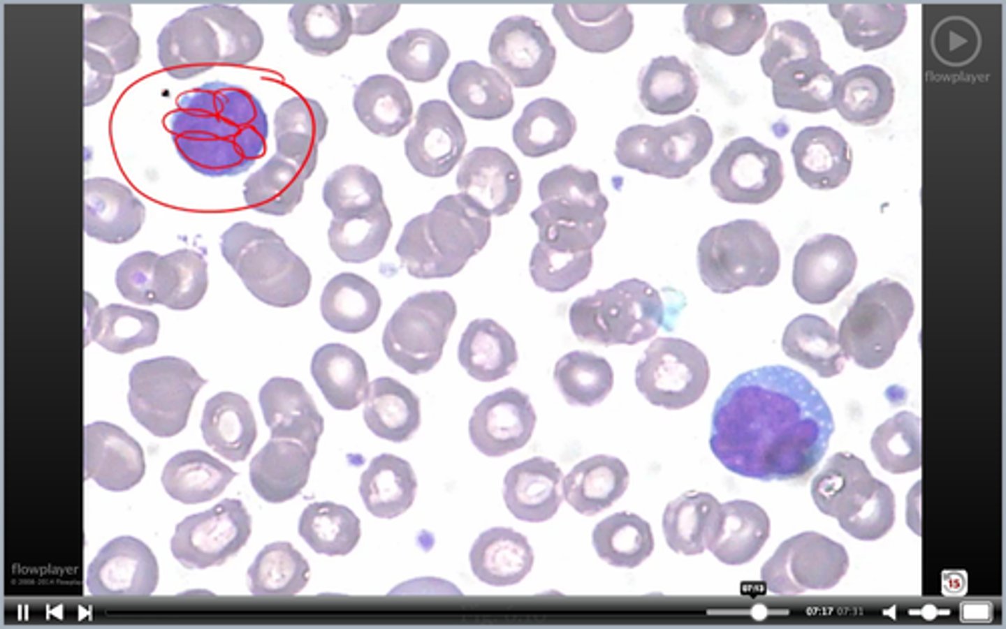 <p>bad T cell</p>