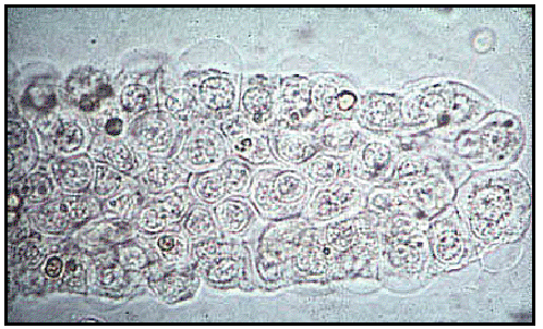 Casts containing DCT cells
