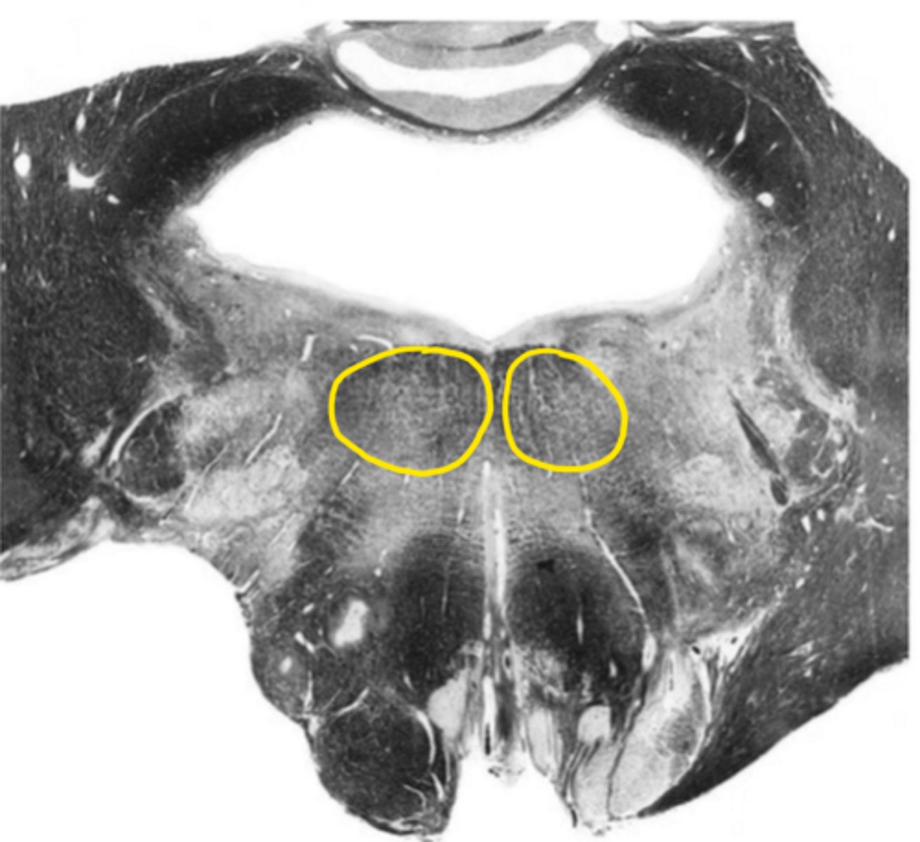 <p>ID the structure</p>