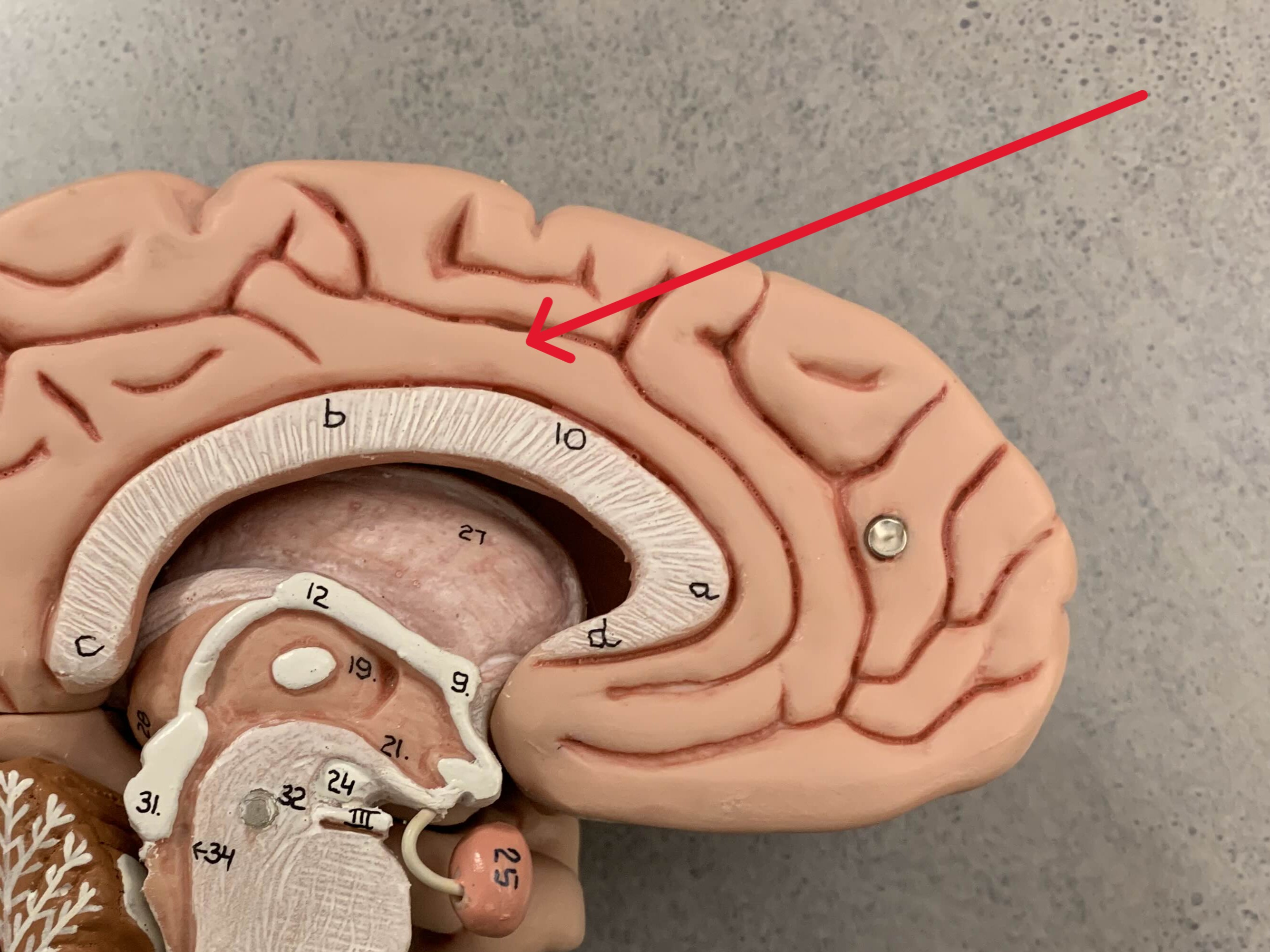 <p>Which part of the brain is:</p><ul><li><p>Arch-shaped</p></li><li><p>Wraps above corpus callosum</p></li></ul><p></p>