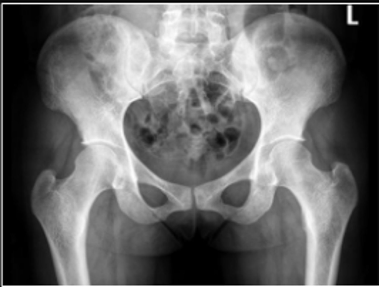 <p>What is the name of the radiographic view?</p>
