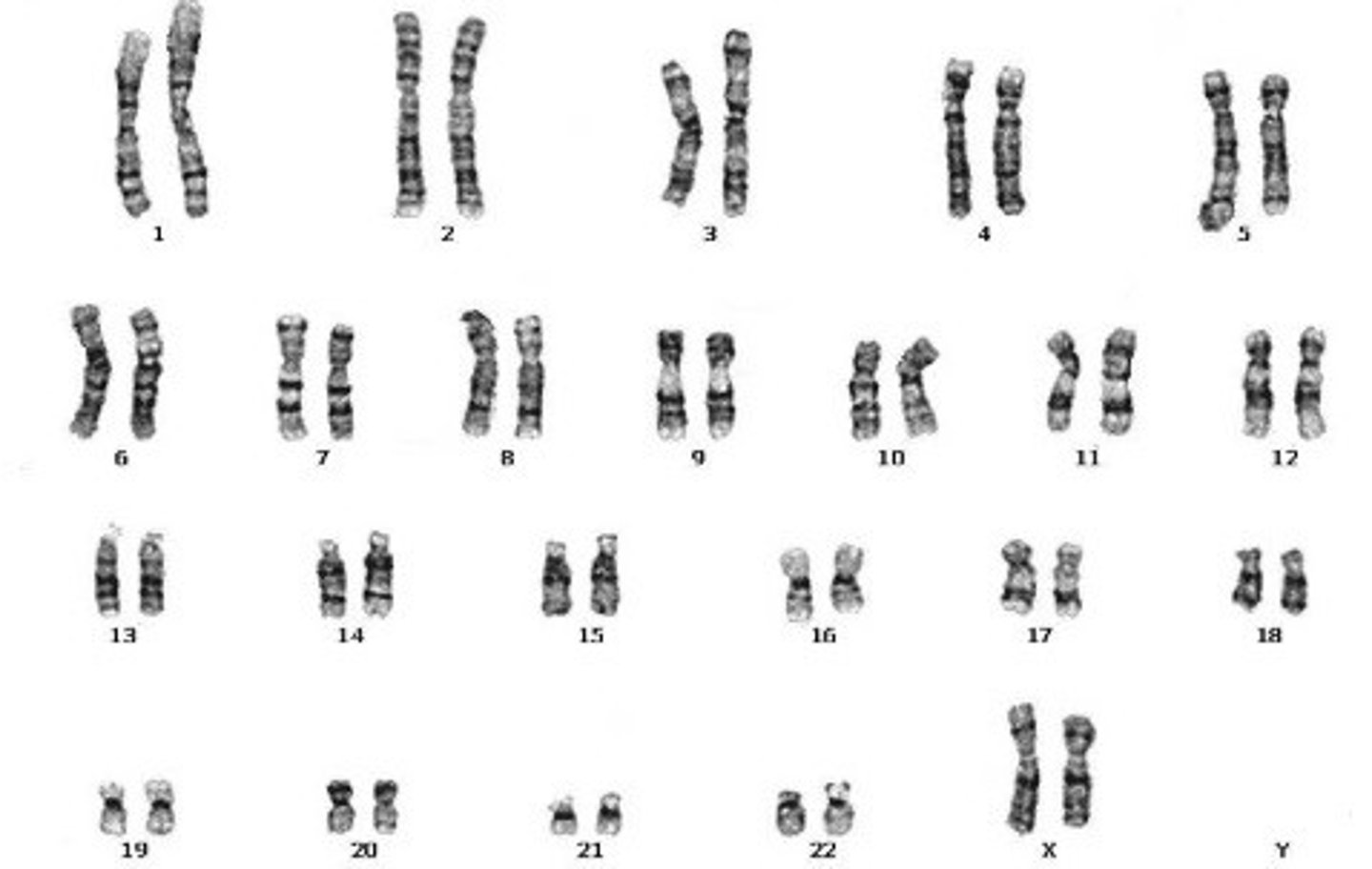 <p>XX - If the 23rd pair of chromosomes are the same size, XX, then the organism is a female.</p>