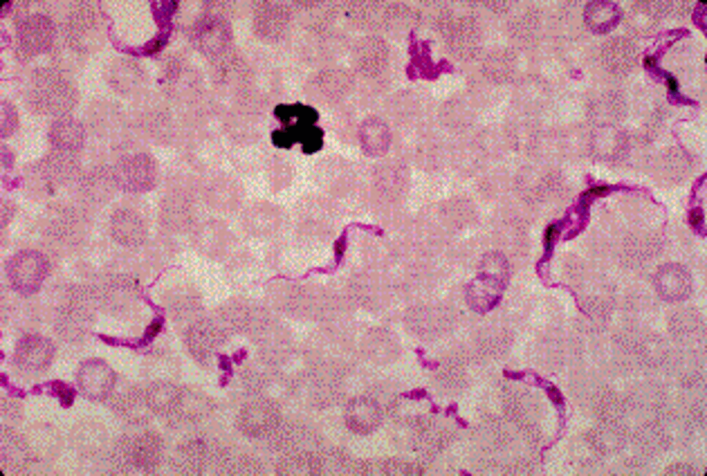 <p>a.Trypanosoma brucei.</p><p>Trypanosoma brucei rhodesiense and Trypanosoma brucei gambiense are the causative agents of human African trypanosomiasis, commonly called sleeping sickness, which is seen primarily in central Africa. The diagnostic stage of trypanosomes in humans is the trypomastigote, which is usually seen in a Wright-stained blood smear. The trypomastigote is 15 to 20 μm long, with a single large nucleus and a posterior kinetoplast to which is attached the flagellum of the undulating membrane.</p>