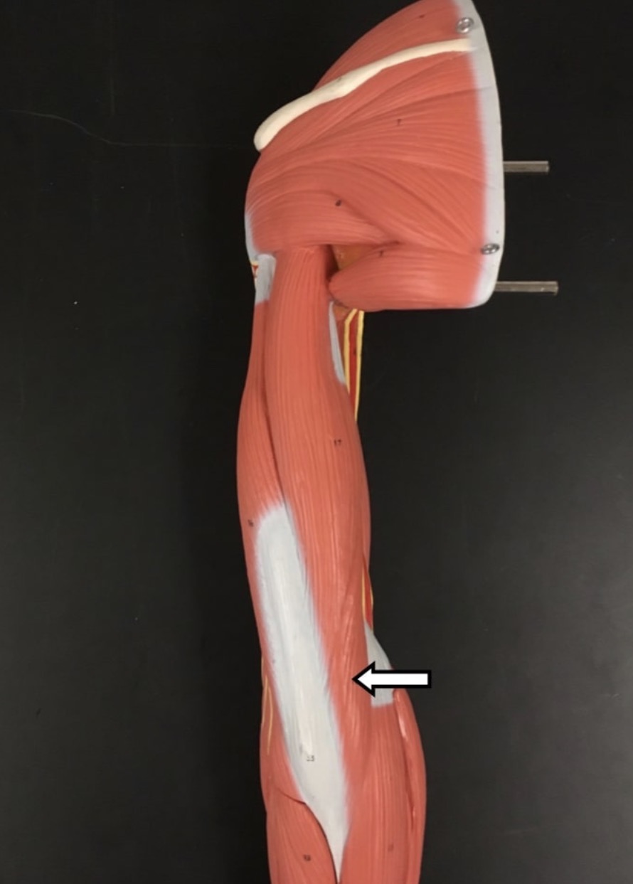 <p><span>Name the muscle labeled with the white arrow below - be specific! - AND name ONE action .</span></p>