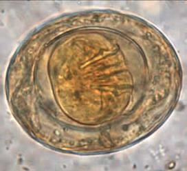 What is this egg