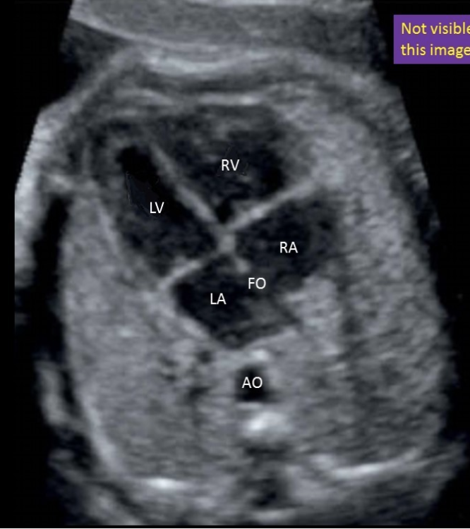 <p>a) top left</p>