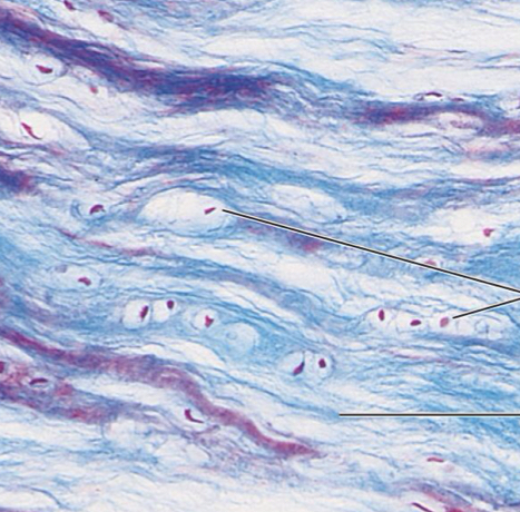 <p>Fibrocartilage </p>