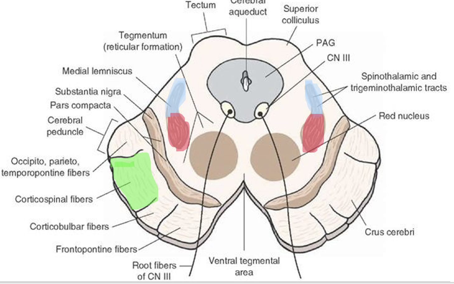<p>green - corticospinal</p><p>red - spinothalamic</p><p>blue - dorsal column - medial lemniscus</p>
