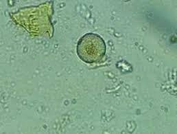 <p>Blastocystis (formerly <em>B. hominis</em>)</p>