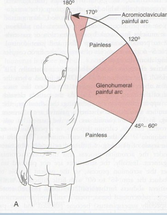 <p><strong>Purpose:</strong> Tests for compression of subacromial structures</p><p><strong>Positive Signs:</strong> Pain during mid-arc, pain at 170-180° indicates AC injury</p><p><strong>Method:</strong> </p><ul><li><p>AFROM abduction</p></li></ul><p></p>