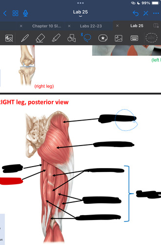 <p>What muscle is this?</p>
