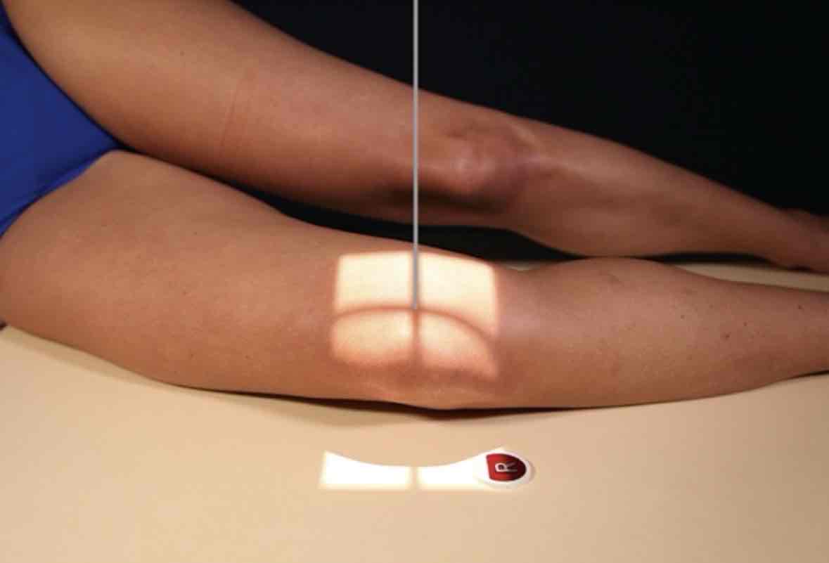 <p>What Projection is this?</p>