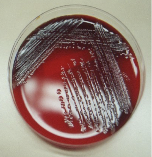 <ol><li><p>Cerebrospinal fluid (CSF) samples are extracted and plated on blood/chocolate agar</p><ul><li><p>CSF should not be refrigerated </p></li></ul></li><li><p>Cultured sample at 35C</p><ul><li><p>Meningococci usually form gray or yellowish colonies</p></li></ul></li></ol><p></p>
