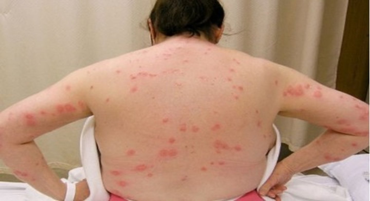 <p>blood feeding parasites, dont transmit disease</p>