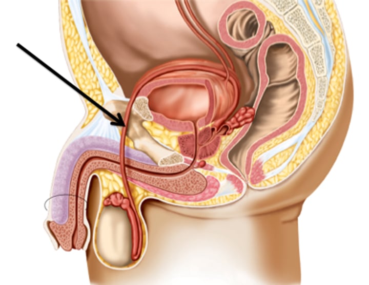 <p>Carries sperm from the epididymis to the ejaculatory duct</p><p>-Tubes connected (leads) to ejaculatory duct</p>