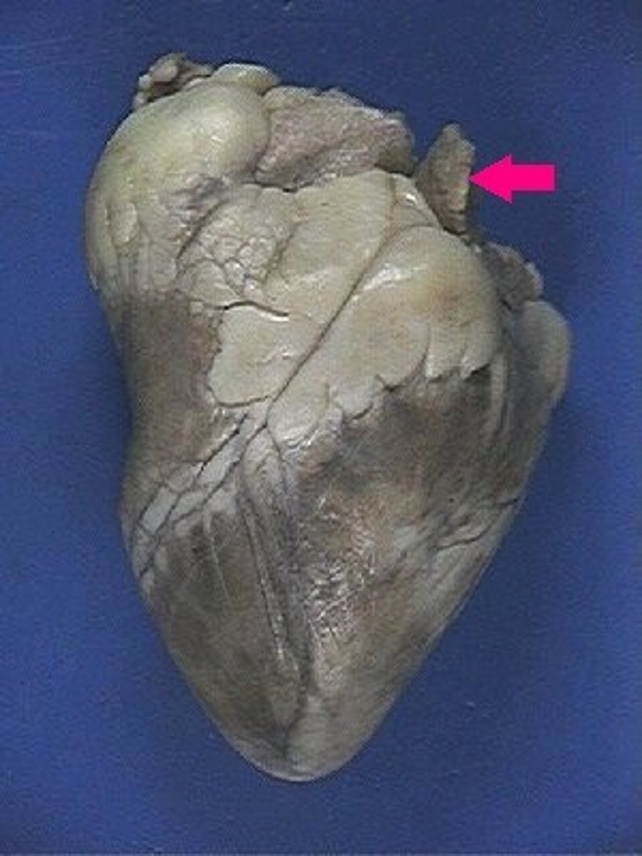 <p>Identify the structure.</p>