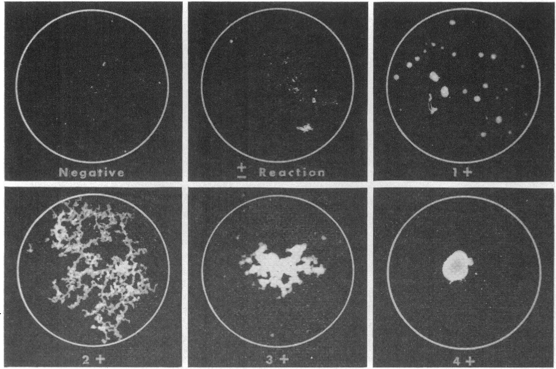 <p>MAT, PCR, dark field microscopy, serology from urine</p>