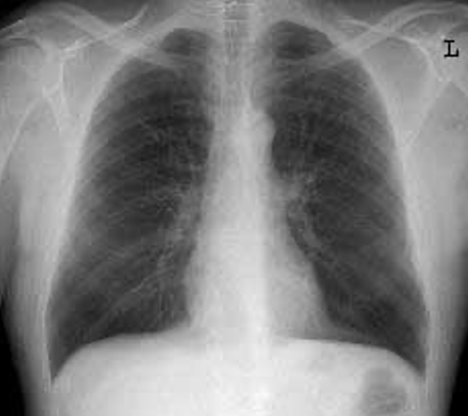 <p>what is this projection</p>