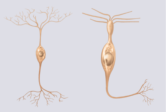 <p>What type of neuron is shown in the given image?</p>