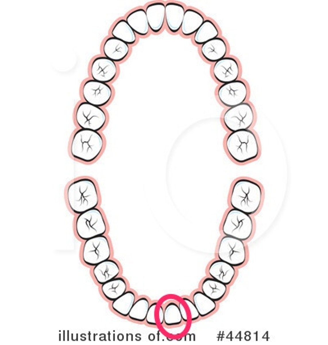 <p>LL central incisor</p>