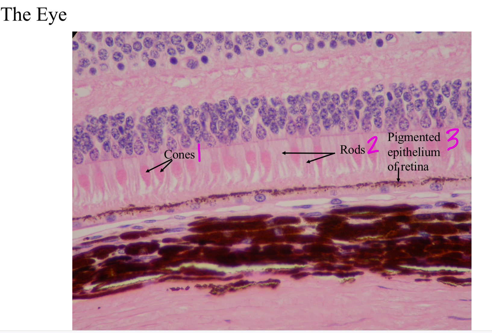 <ol><li><p>Cones</p></li><li><p>Rods</p></li><li><p>Pigmented epithelium of retina</p></li></ol>